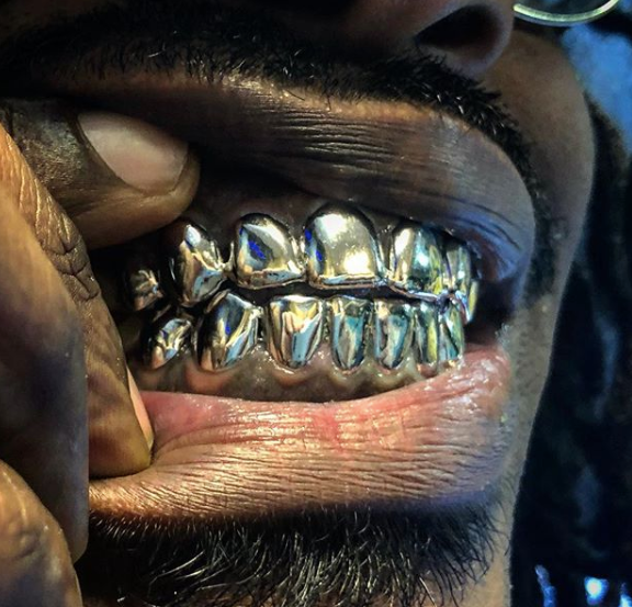 Solid Classics (Sold Per Tooth)