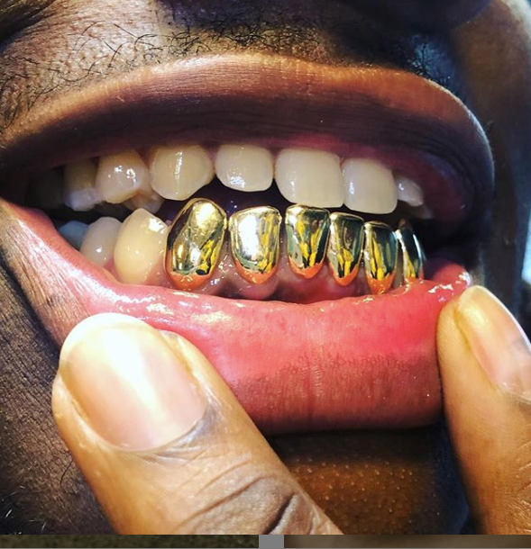 Permanent Style (Sold Per Tooth)