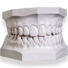 Mold Kit (Dental Impression)