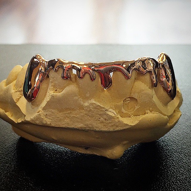 Drips (Sold as a Set)