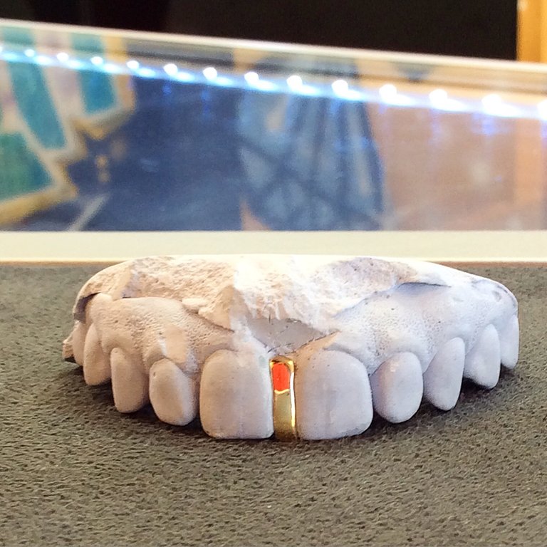 Gap Filler (Sold Single)