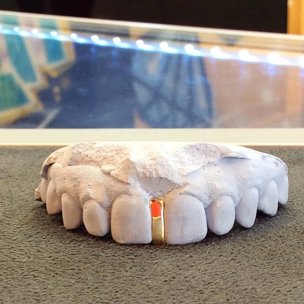 Gap Filler (Sold Single)