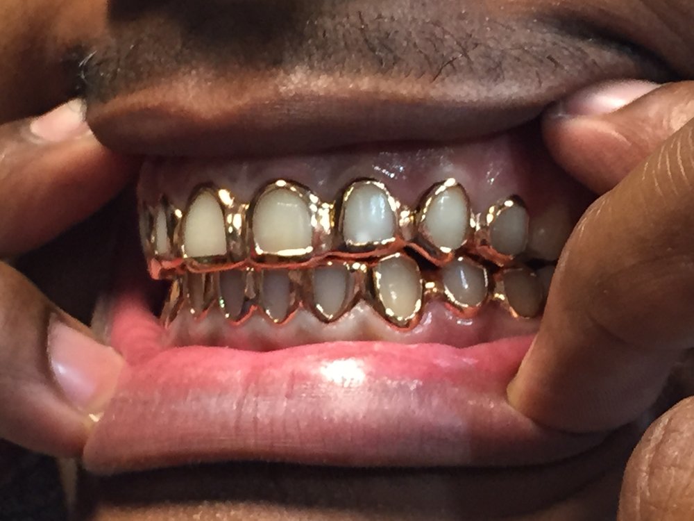 Classic Open Faces (Sold Per Tooth)