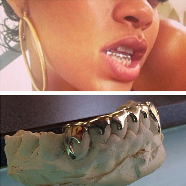 Rihanna Inspired Grillz (Sold as a Set)