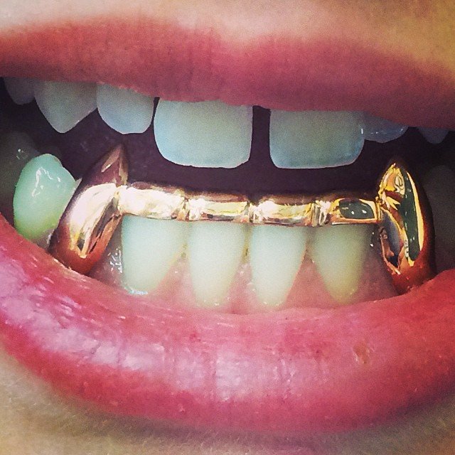 Beyonce Grill (Sold as a Set)