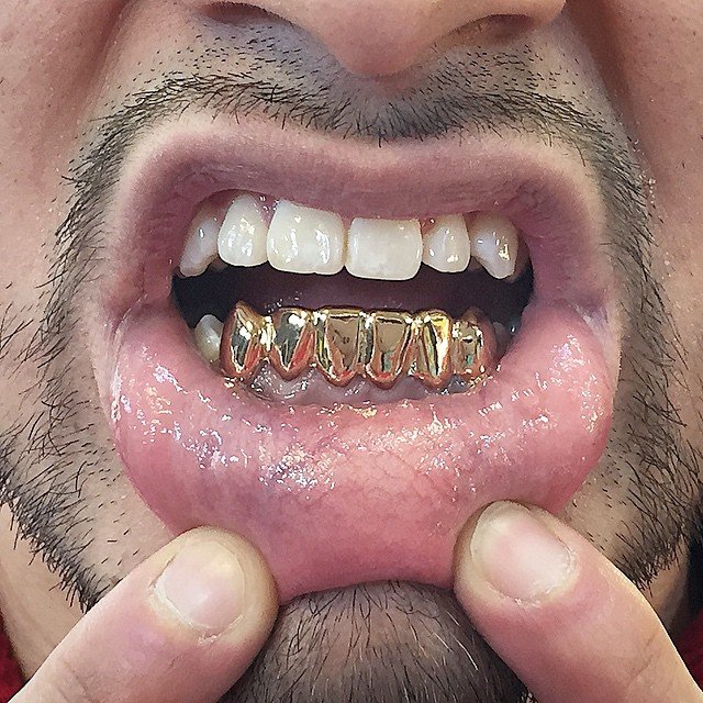 Solid Classics (Sold Per Tooth)